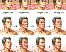 Qué cambios hay en la piel durante el uso de Esteroides Cursos en solitario